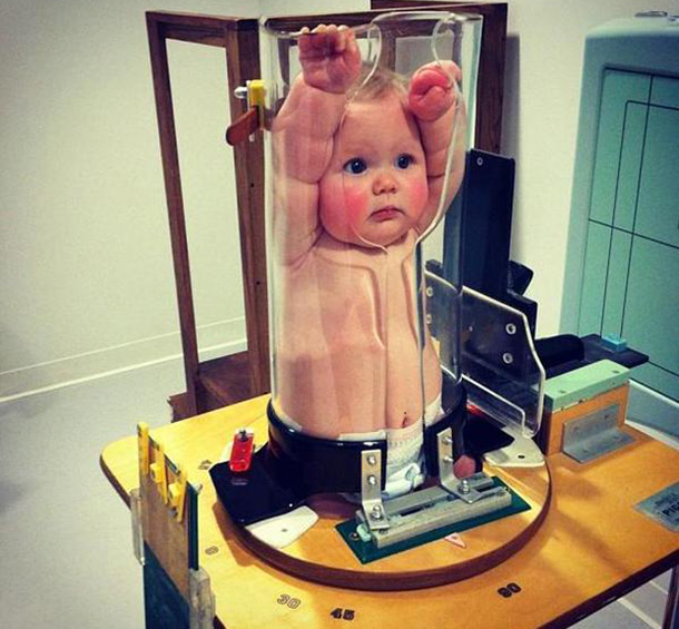 ¿Cómo hacer una radiografía a un bebe que no se está quieto?