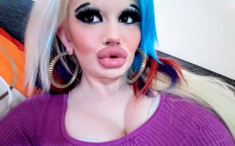 Esta mujer se ha operado 15 veces para tener estos labios