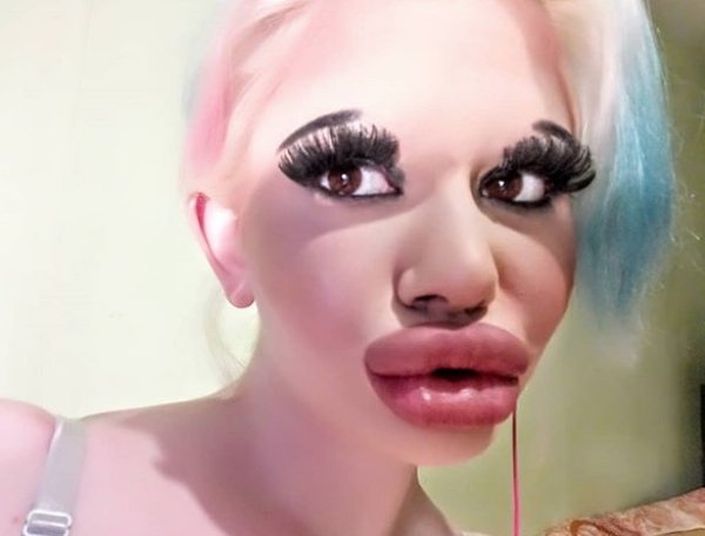 Esta mujer se ha operado 15 veces para tener estos labios