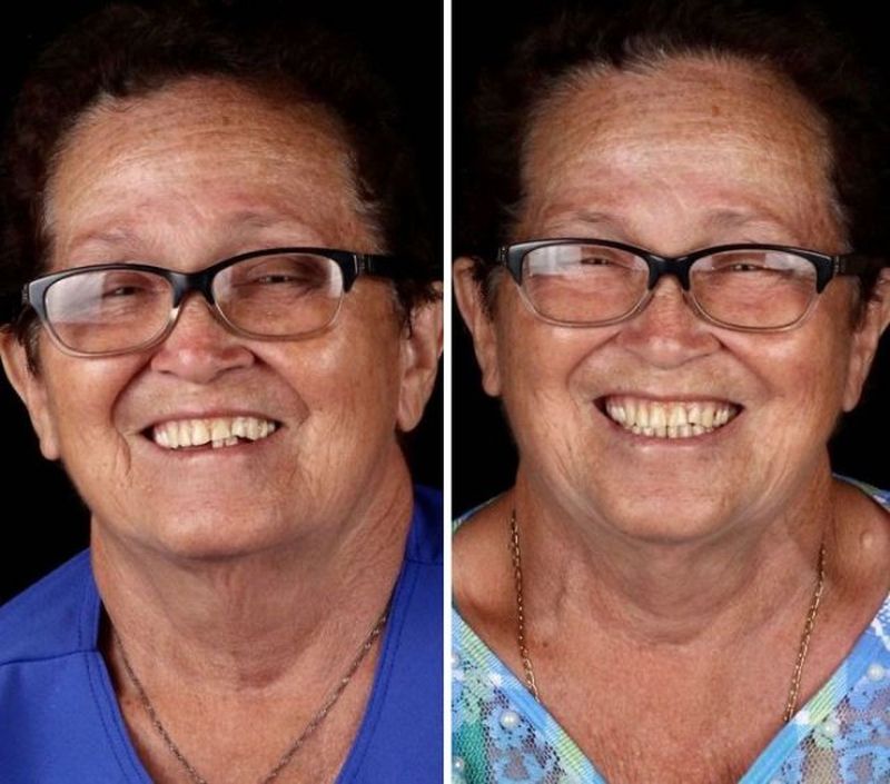 Un dentista brasileño va a zonas pobres para arreglar la boca a la gente de forma gratuita