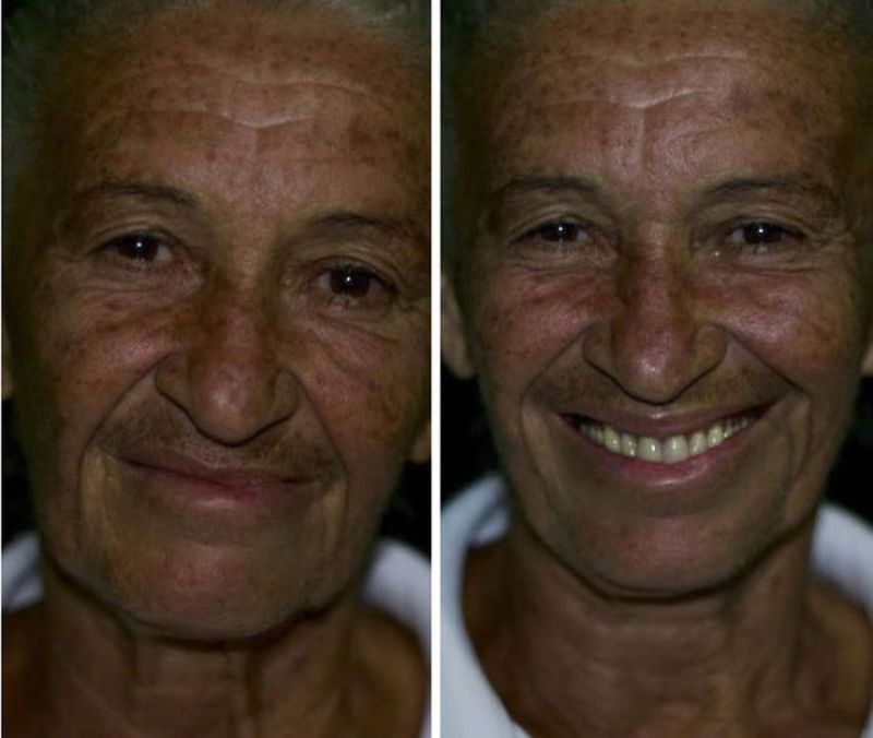 Un dentista brasileño va a zonas pobres para arreglar la boca a la gente de forma gratuita
