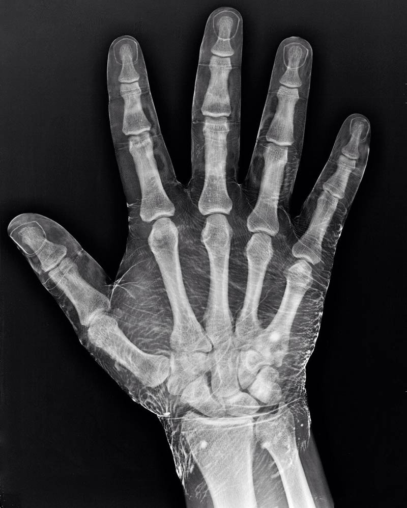 ¿Por qué se ve tan bien la radiografía de esta mano?