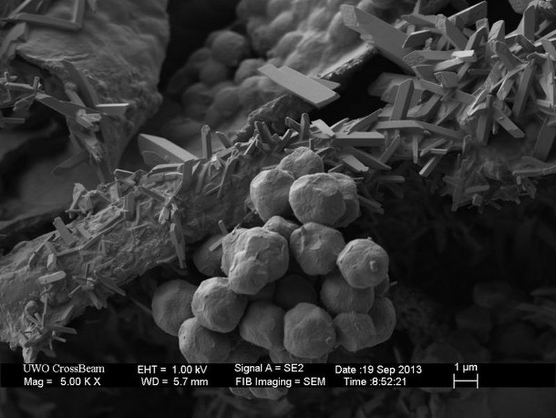 Objetos cotidiandos vistos desde un microscopio electronico