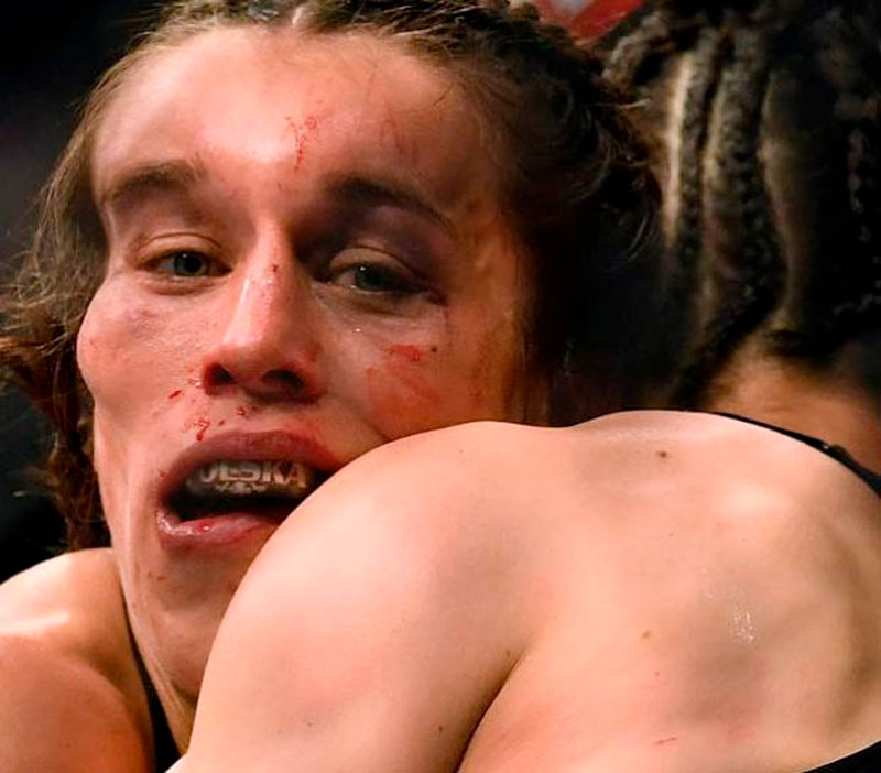 La luchadora Joanna Jedrzejczyk acaba con la cara desfigurada tras un combate de MMA