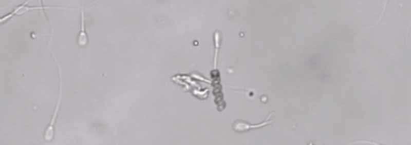 Video de un nanorobot empujando a un espermatozoide vago hacia el óvulo
