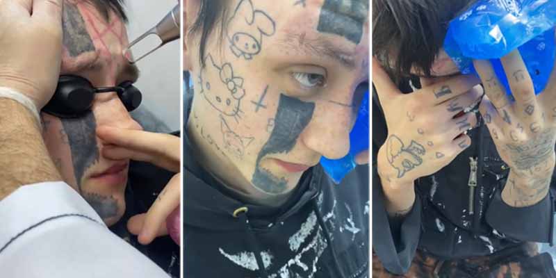 ¿Sabéis esa gente que se ha tatuado toda la cara de joven? Esto sufrirán cuando se arrepientan