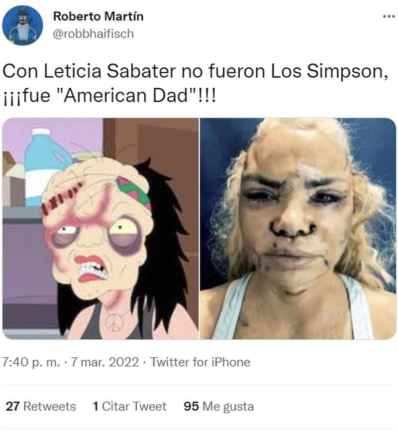 Leticia Sabater se opera la cara y publica estas fotografías