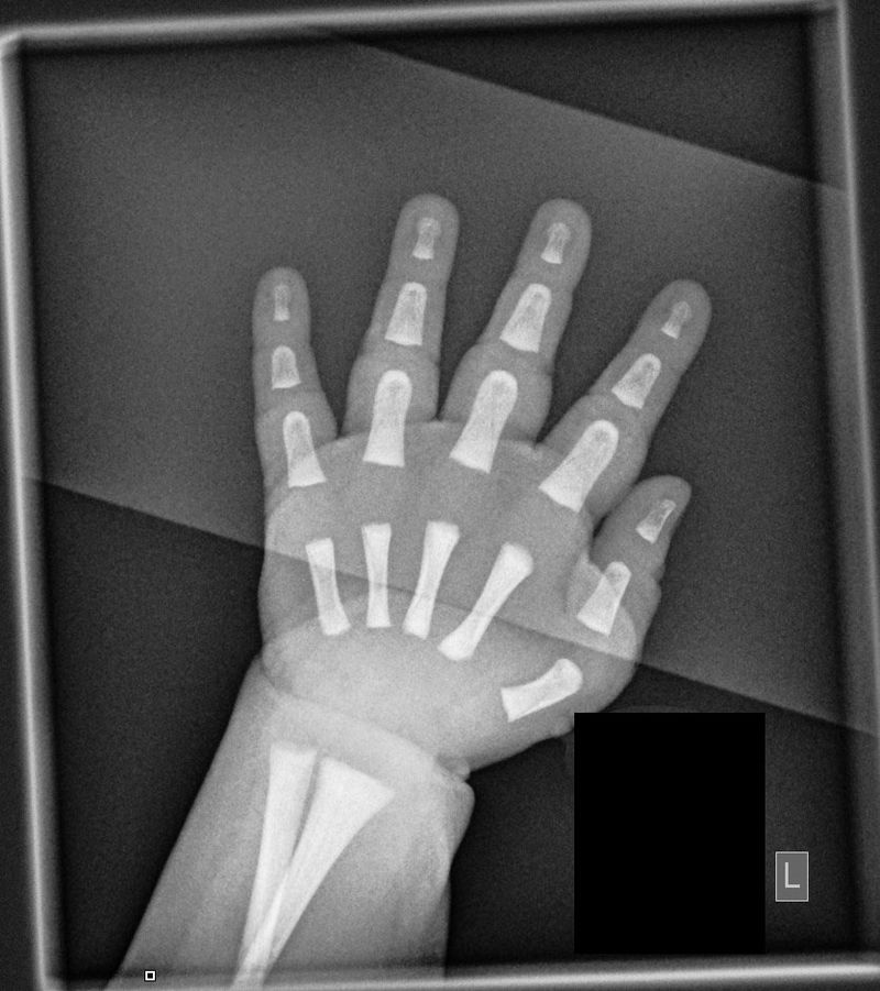 ¿Alguna vez habías visto la radiografía de la mano de un bebé?