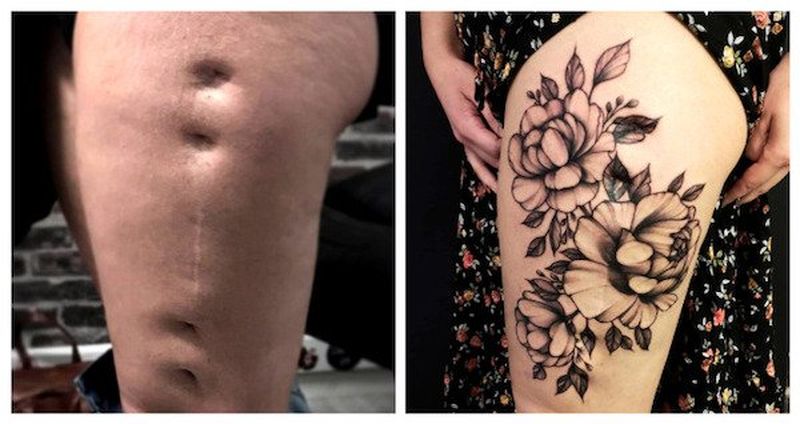 Ocultando cicatrices con tatuajes