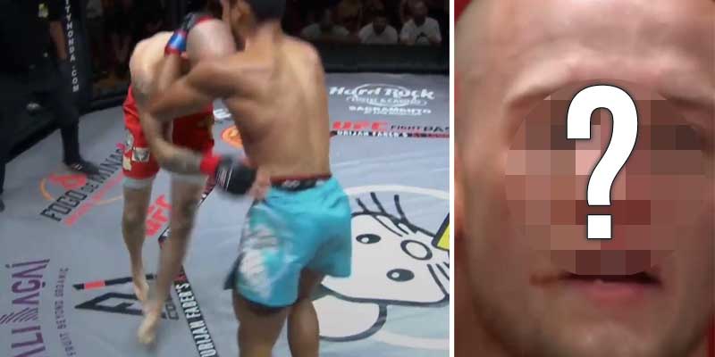 Atentos a como le queda la nariz a este luchador de MMA durante un combate