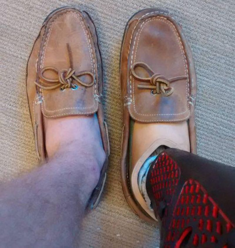 La diferencia en el desgaste del calzado entre una pierna normal y una prótesis después de un año