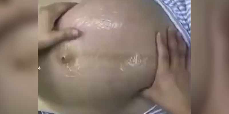 Girando al bebé dentro de la barriga de la madre