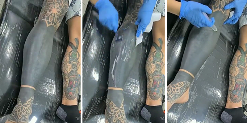 Así es el proceso de eliminación de un tatuaje sólido
